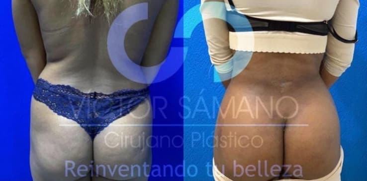 Slider image (9) Cancun Plastic Surgery Center by Dr. Víctor Sámano